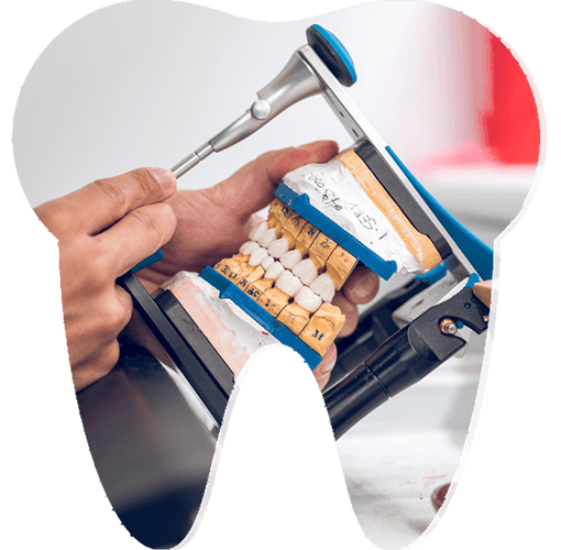 All on four implant izmir