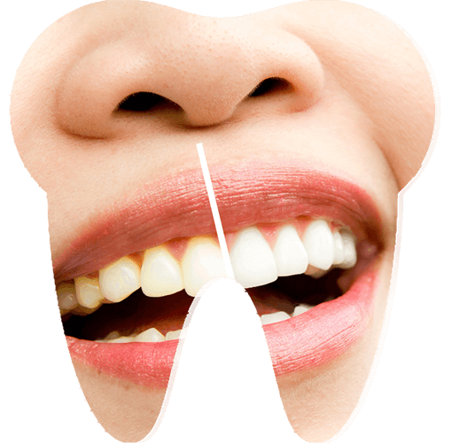 İzmir Pembe estetik