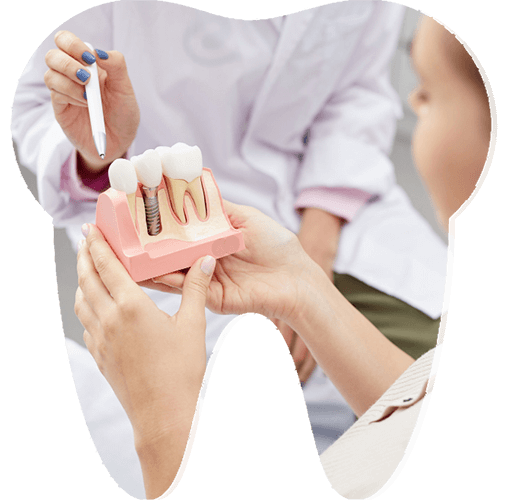 Vidasız İmplant Fiyatları İzmir