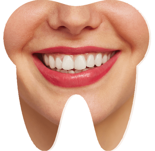 Zirkonyum Gülüş Tasarımı Fiyatları İzmir