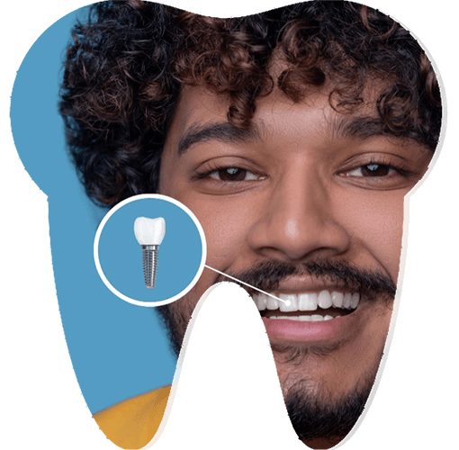 Zirkonyum Kaplama İzmir